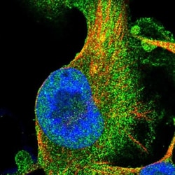 ANKIB1 Antibody, Novus Biologicals 25 &mu;L; Unlabeled:Antibodies, Polyclonal